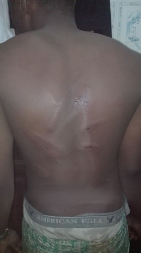 Victims of the soldier assault, Sage Lodge MOUAU, July 18, 2016