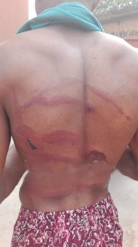 Victims of the soldier assault, Sage Lodge MOUAU, July 18, 2016